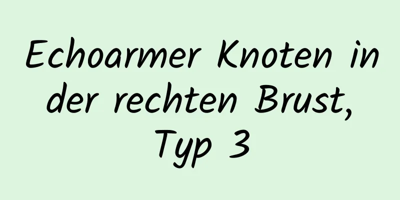 Echoarmer Knoten in der rechten Brust, Typ 3