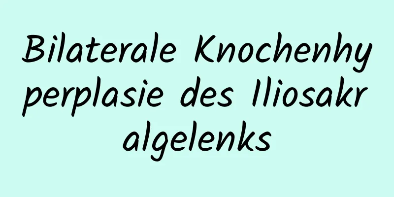 Bilaterale Knochenhyperplasie des Iliosakralgelenks