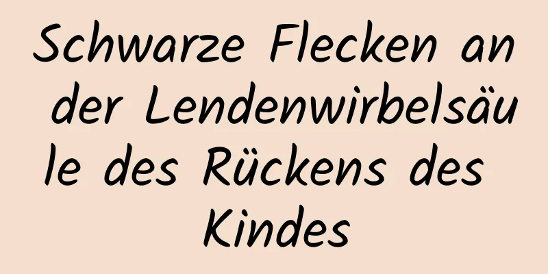 Schwarze Flecken an der Lendenwirbelsäule des Rückens des Kindes