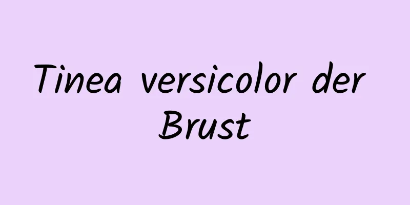 Tinea versicolor der Brust