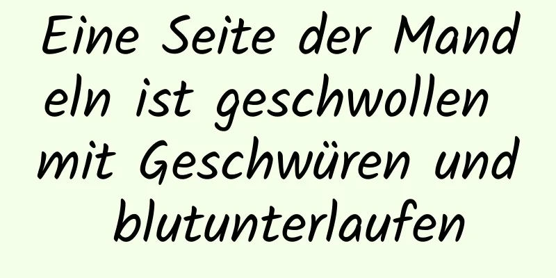 Eine Seite der Mandeln ist geschwollen mit Geschwüren und blutunterlaufen