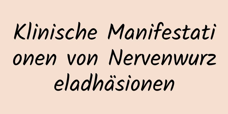 Klinische Manifestationen von Nervenwurzeladhäsionen