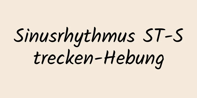 Sinusrhythmus ST-Strecken-Hebung