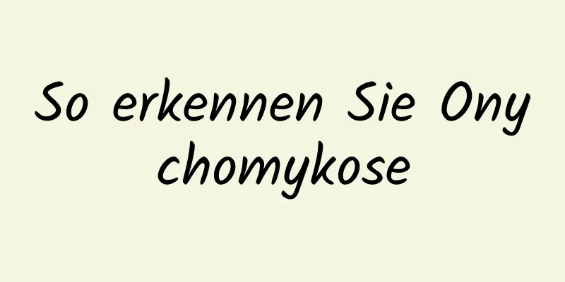 So erkennen Sie Onychomykose