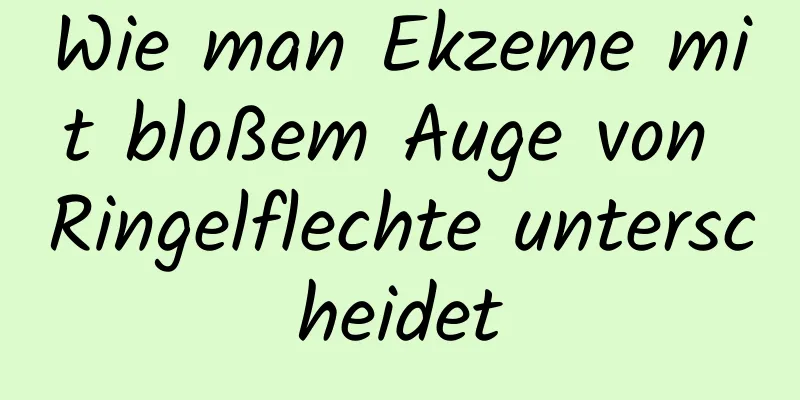 Wie man Ekzeme mit bloßem Auge von Ringelflechte unterscheidet