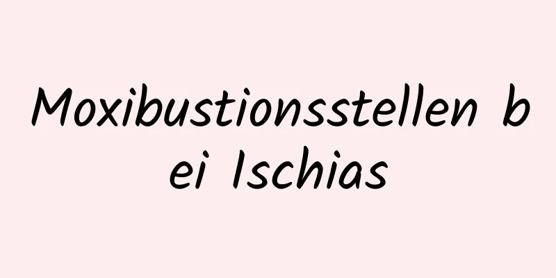 Moxibustionsstellen bei Ischias