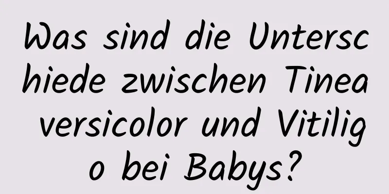 Was sind die Unterschiede zwischen Tinea versicolor und Vitiligo bei Babys?