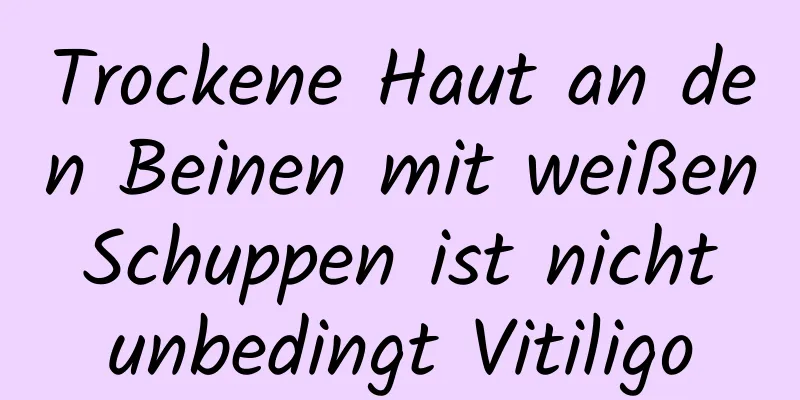 Trockene Haut an den Beinen mit weißen Schuppen ist nicht unbedingt Vitiligo