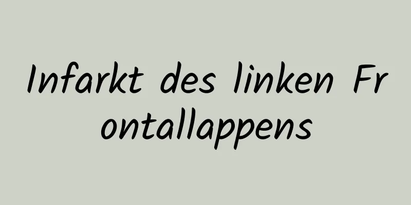 Infarkt des linken Frontallappens