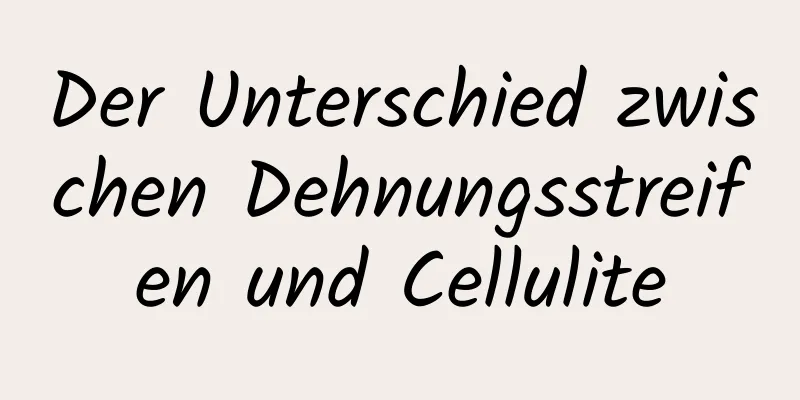 Der Unterschied zwischen Dehnungsstreifen und Cellulite