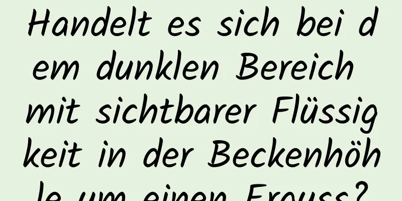 Handelt es sich bei dem dunklen Bereich mit sichtbarer Flüssigkeit in der Beckenhöhle um einen Erguss?