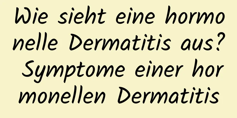 Wie sieht eine hormonelle Dermatitis aus? Symptome einer hormonellen Dermatitis