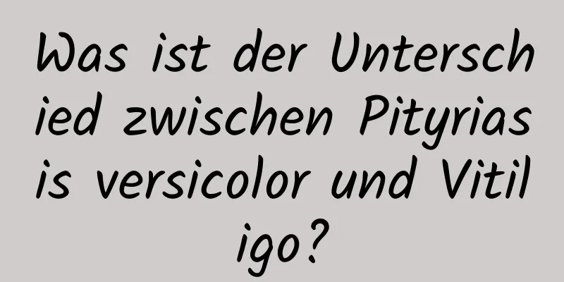 Was ist der Unterschied zwischen Pityriasis versicolor und Vitiligo?