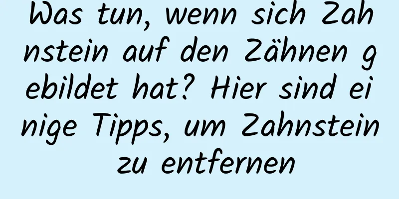 Was tun, wenn sich Zahnstein auf den Zähnen gebildet hat? Hier sind einige Tipps, um Zahnstein zu entfernen