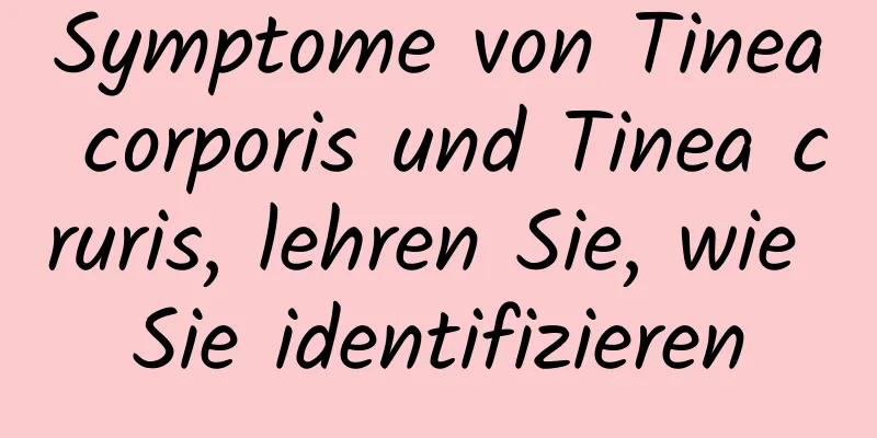 Symptome von Tinea corporis und Tinea cruris, lehren Sie, wie Sie identifizieren