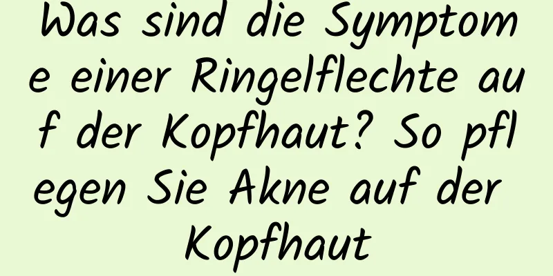 Was sind die Symptome einer Ringelflechte auf der Kopfhaut? So pflegen Sie Akne auf der Kopfhaut