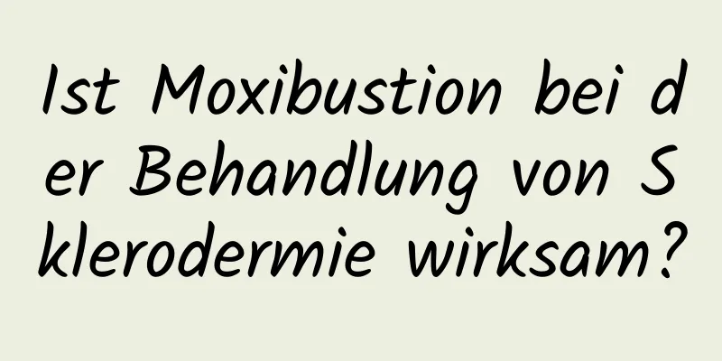 Ist Moxibustion bei der Behandlung von Sklerodermie wirksam?