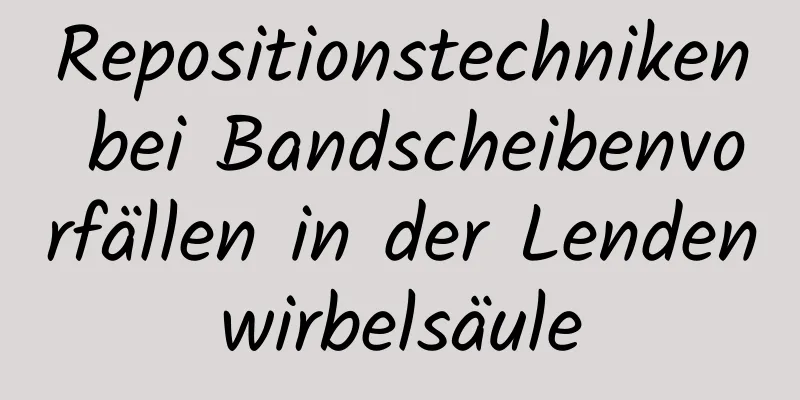 Repositionstechniken bei Bandscheibenvorfällen in der Lendenwirbelsäule