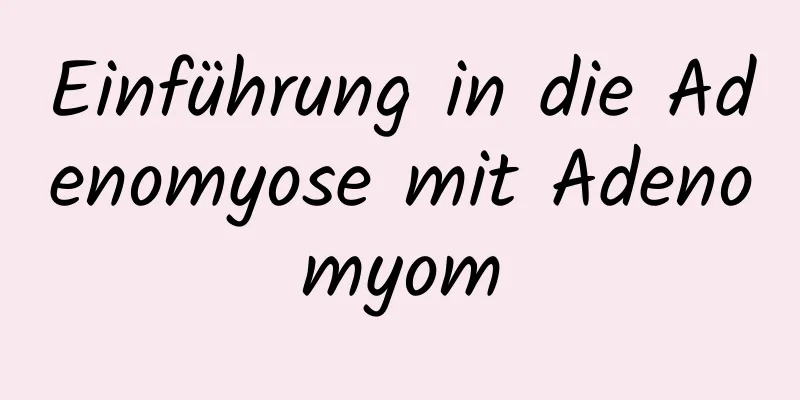 Einführung in die Adenomyose mit Adenomyom