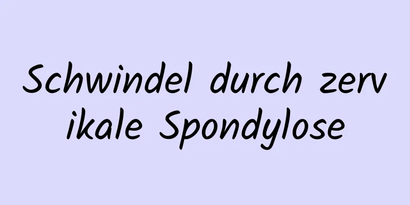 Schwindel durch zervikale Spondylose