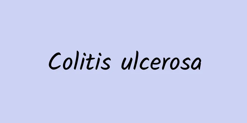 Colitis ulcerosa