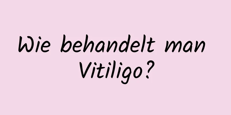 Wie behandelt man Vitiligo?