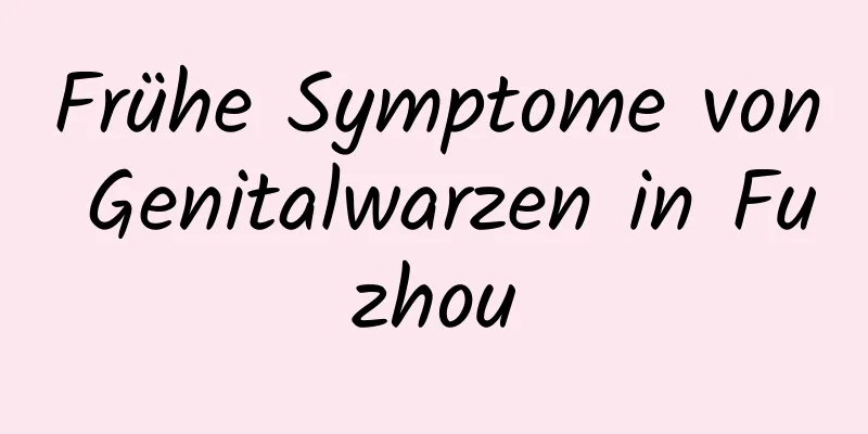Frühe Symptome von Genitalwarzen in Fuzhou