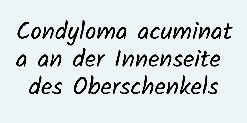 Condyloma acuminata an der Innenseite des Oberschenkels
