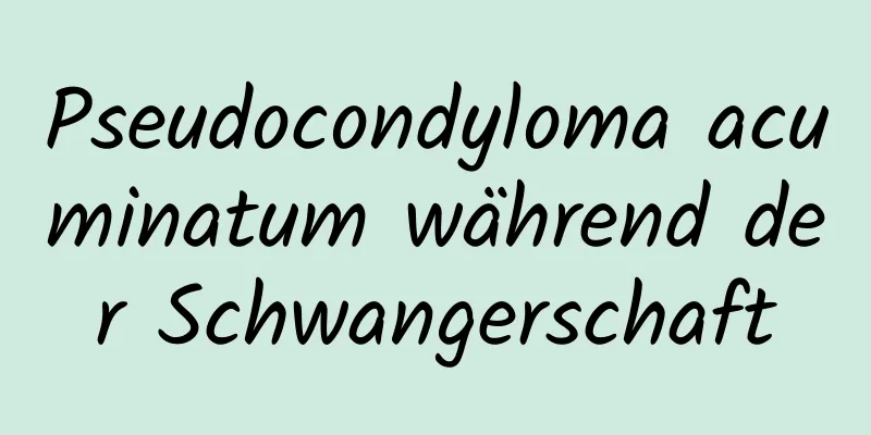 Pseudocondyloma acuminatum während der Schwangerschaft