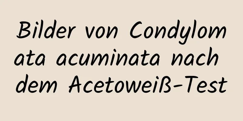 Bilder von Condylomata acuminata nach dem Acetoweiß-Test