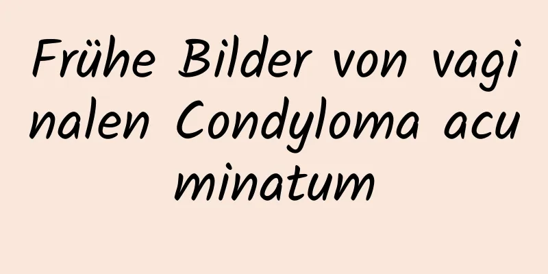 Frühe Bilder von vaginalen Condyloma acuminatum