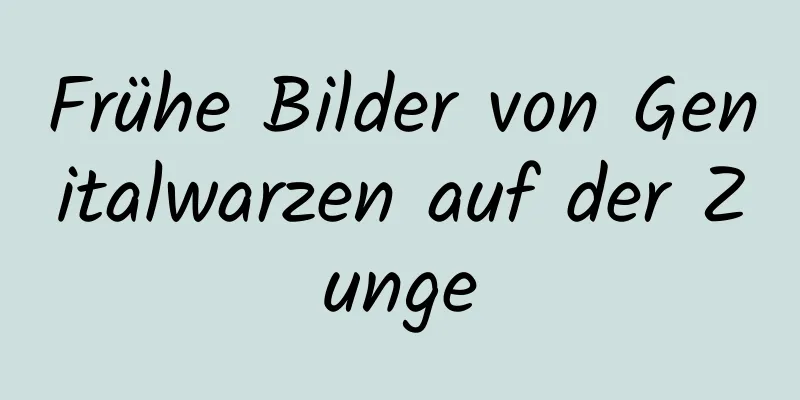 Frühe Bilder von Genitalwarzen auf der Zunge