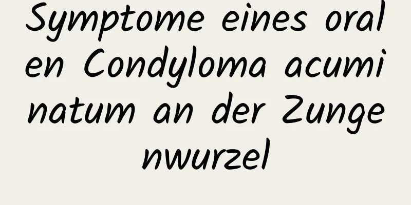 Symptome eines oralen Condyloma acuminatum an der Zungenwurzel