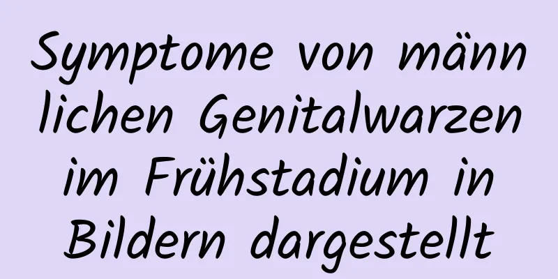 Symptome von männlichen Genitalwarzen im Frühstadium in Bildern dargestellt