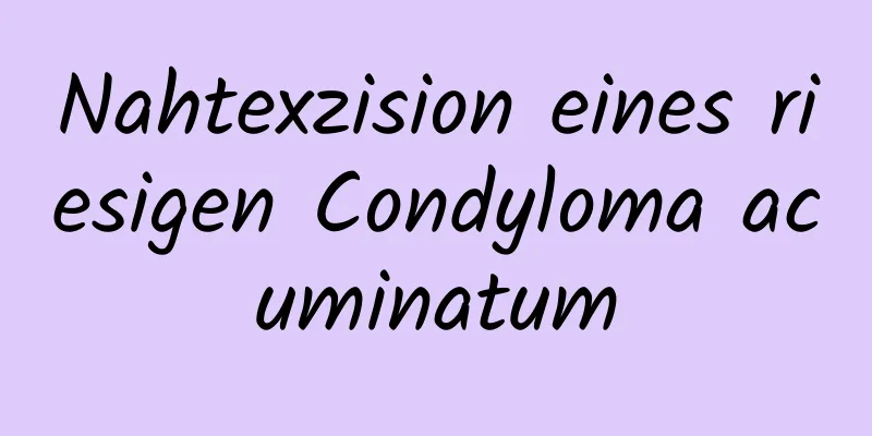 Nahtexzision eines riesigen Condyloma acuminatum